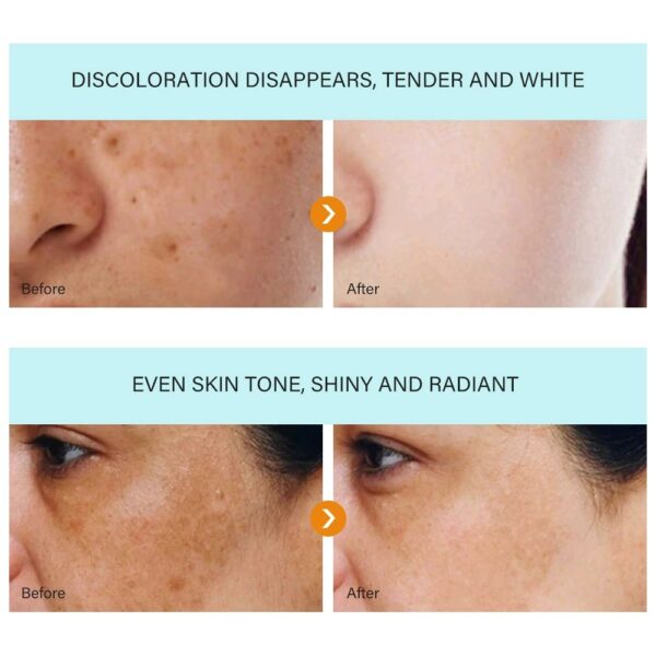 Dark Spot Removal Cream, Whitening Freckle Cream for Brightening Skin Tone